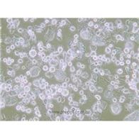 E.G7-OVA小鼠T淋巴瘤細胞