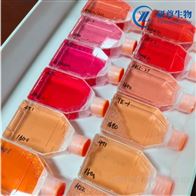 KMS-21BM_人多發性骨髓瘤細胞