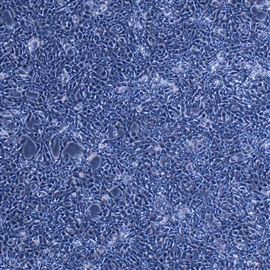 人乳腺導管癌細胞HCC70(STR鑒定正確)