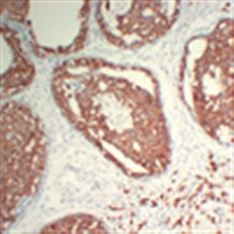 Atg16L2 rabbit pAb