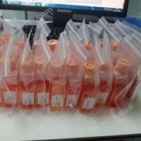NK-92人惡性非霍奇金淋巴瘤