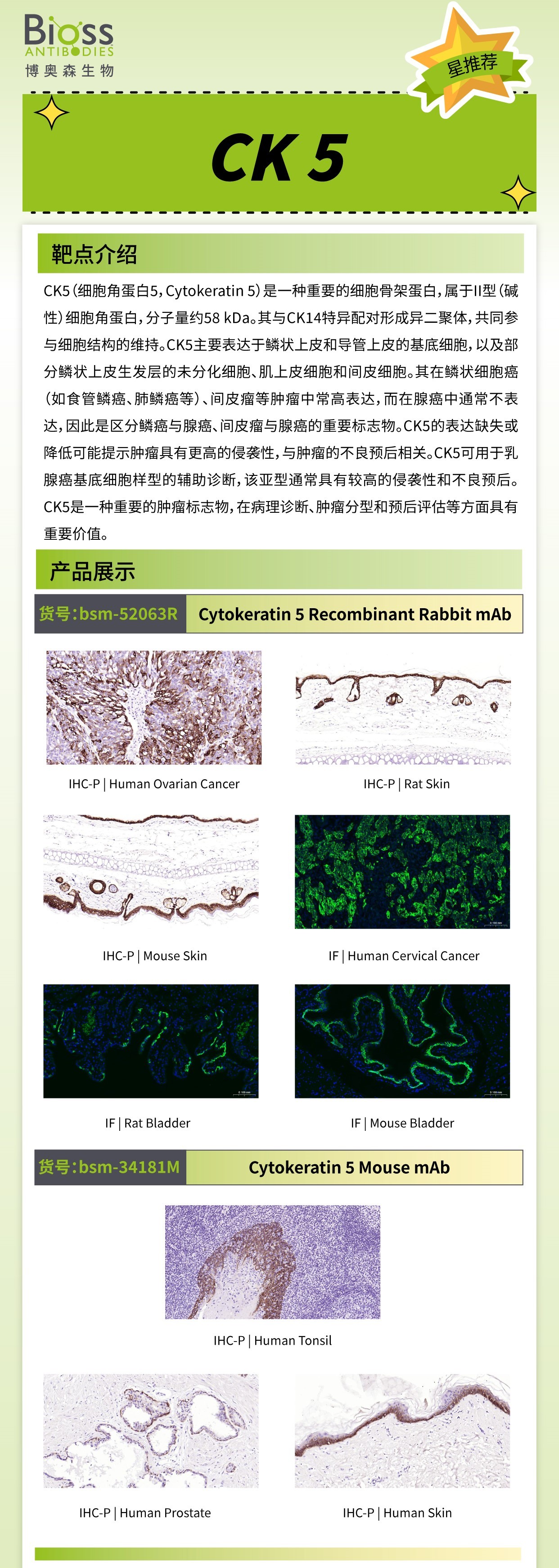 Cytokeratin-5 v1.jpg