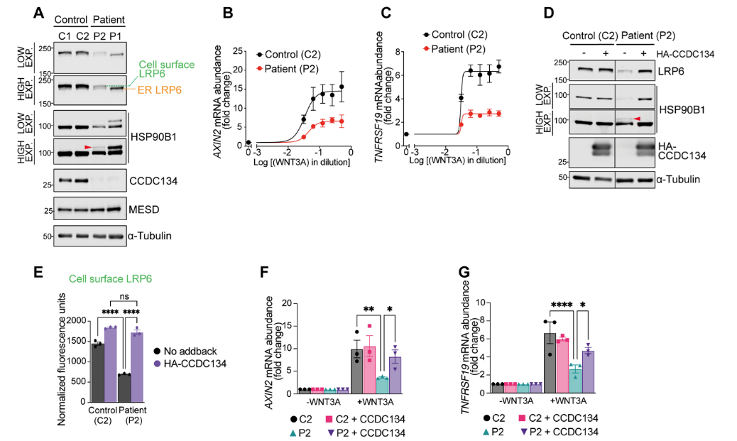 CRISPR筛选和糖蛋白质组学联合研究发现新型WNT通路的N-糖基化调控机制