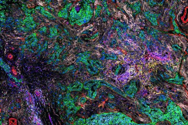 顯微課堂 | 人工智能驅動的乳腺癌研究多重染色成像空間分析工具