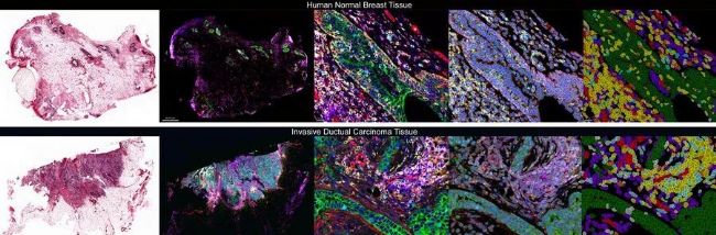 顯微課堂 | 人工智能驅動的乳腺癌研究多重染色成像空間分析工具