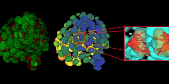 顯微課堂 | 人工智能驅動的乳腺癌研究多重染色成像空間分析工具