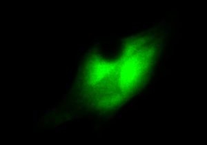 顯微課堂 | 無限遠光學系統