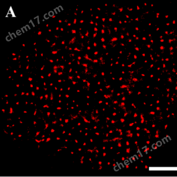 TIRF照明STORM超分辨顯微鏡