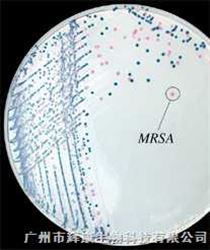 科玛嘉大肠杆菌O157显色培养基