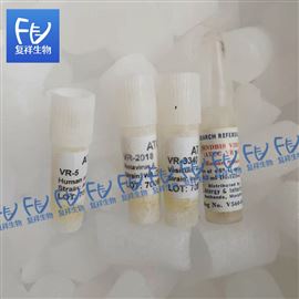 Vesicular stomatitis virus ATCC VR-3340